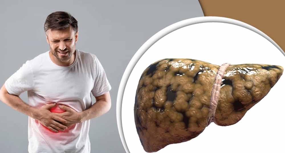 লিভারে চর্বি জমেছে কি না বুঝর উপায় ও সমাধান